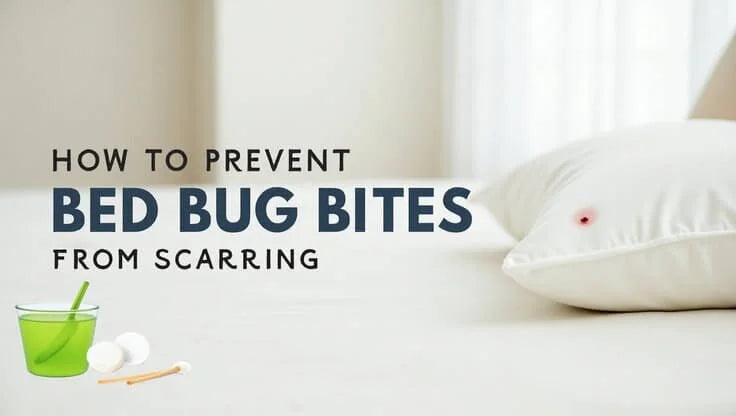 How to Prevent Bed Bug Bites from Scarring: Expert Tips